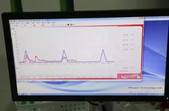 宁波妇儿医院盆底修复,宁波盆底修复哪里好
