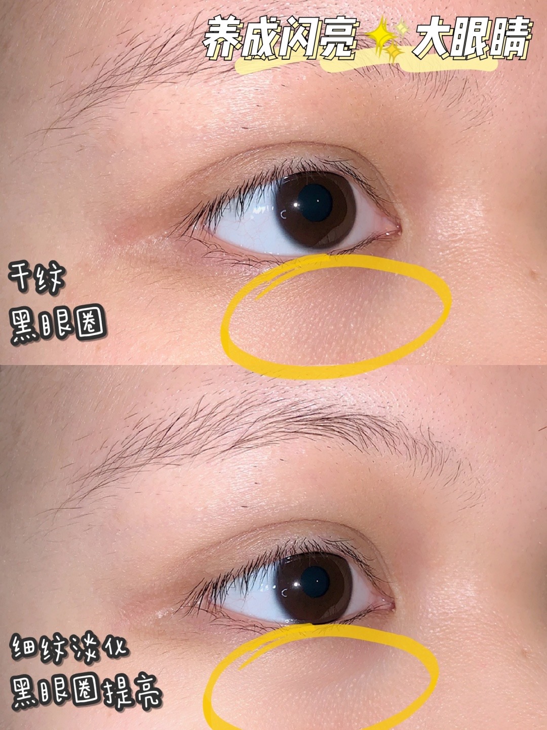 欧莱雅紫熨斗眼霜看起来很廉价,真实有用的眼霜推荐