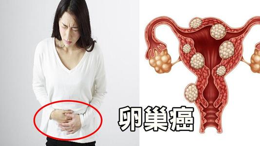 女性高发的三大癌症是哪些？早期筛查必看攻略，请接收