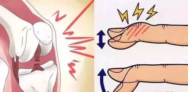 健身时关节有异响还能继续运动吗,训练时关节为什么会响