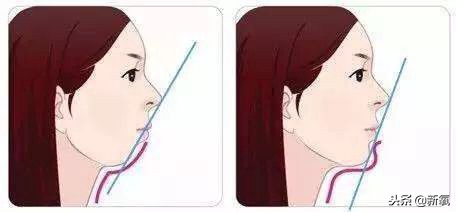 辛芷蕾是苦相女生吗,辛芷蕾气质怎么养成