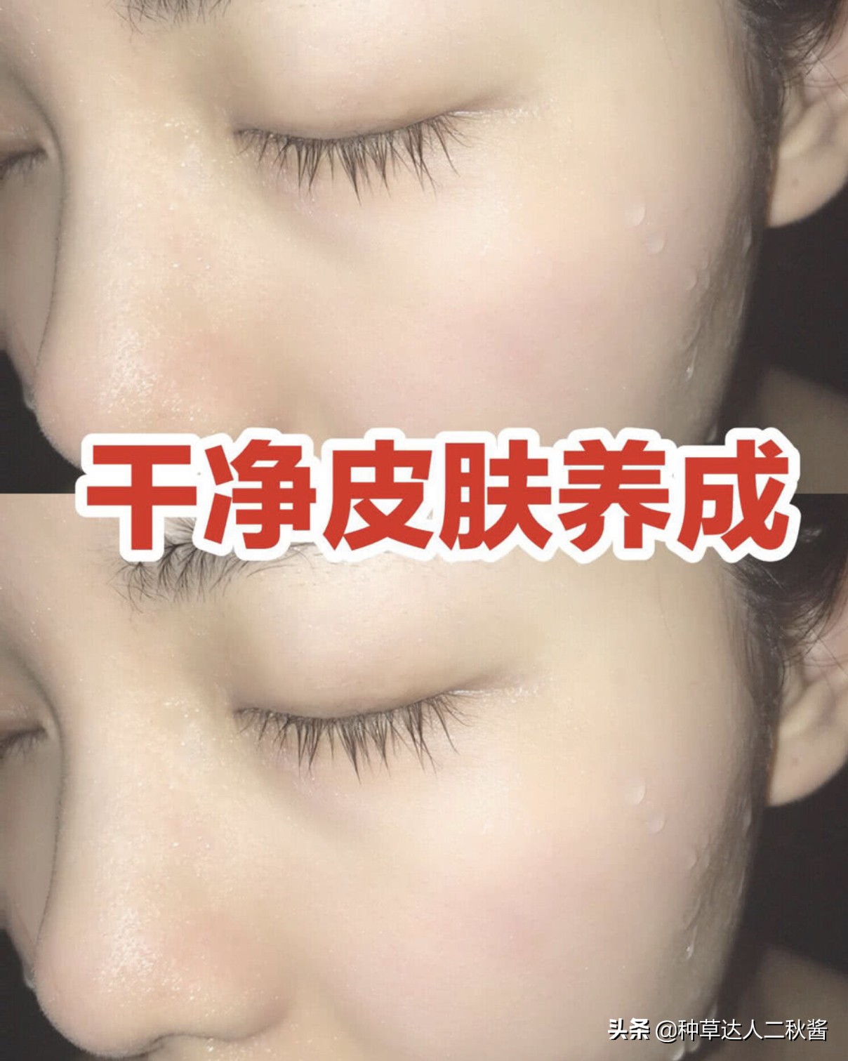 男士毛孔粗大出油黑头用什么护肤,毛孔粗大皮肤干如何正确护肤