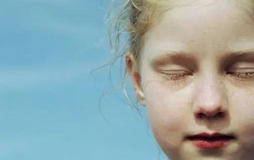 甲亢引起的眼球突出多久能恢复,甲亢导致眼球突出四五年了