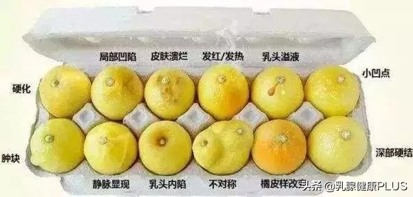 看一张图判断你是否有抑郁症,乳腺癌的肉眼观和镜下观怎么区分