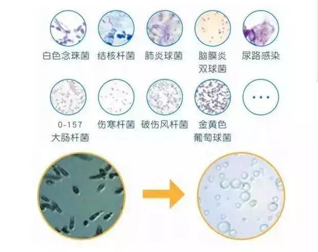 73岁人大代表研发洗衣神器，十年油汗渍霉菌，异味顽垢，轻松泡走