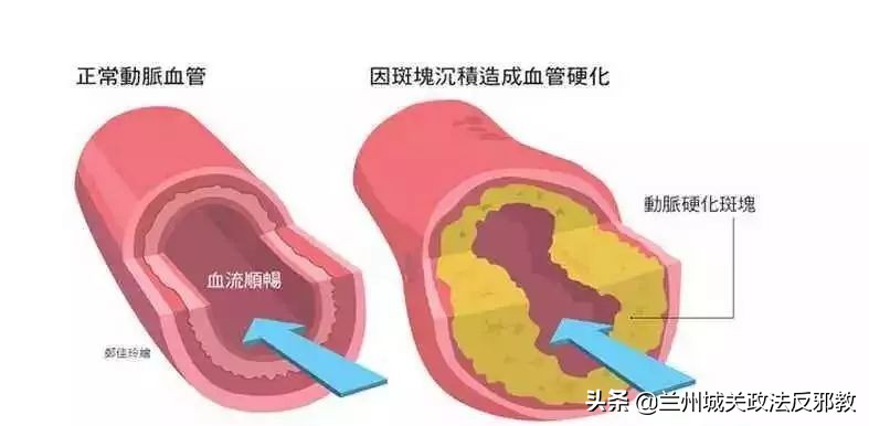 睡觉时手麻怎样能缓解呢,睡觉时总是手麻怎么回事中医