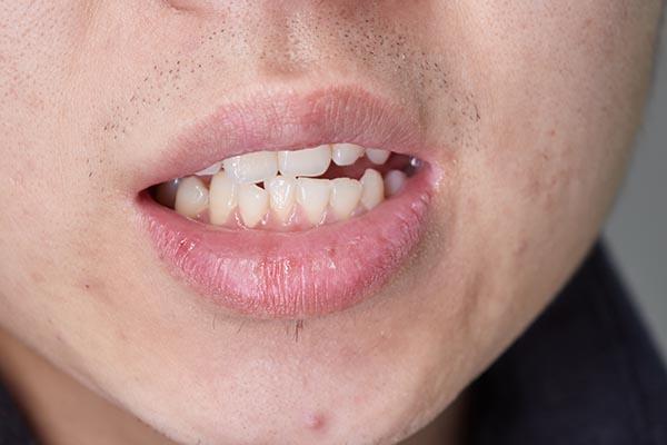 早上起来，嘴巴里异味明显？教你小妙招，让口腔异味消失