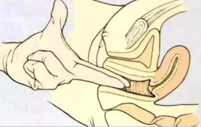 内检都检查什么,内检都检查哪些