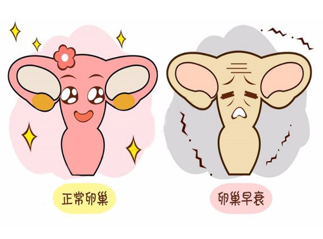 卵巢囊肿导致卵巢功能下降,卵巢功能下降怎么调用什么中成药