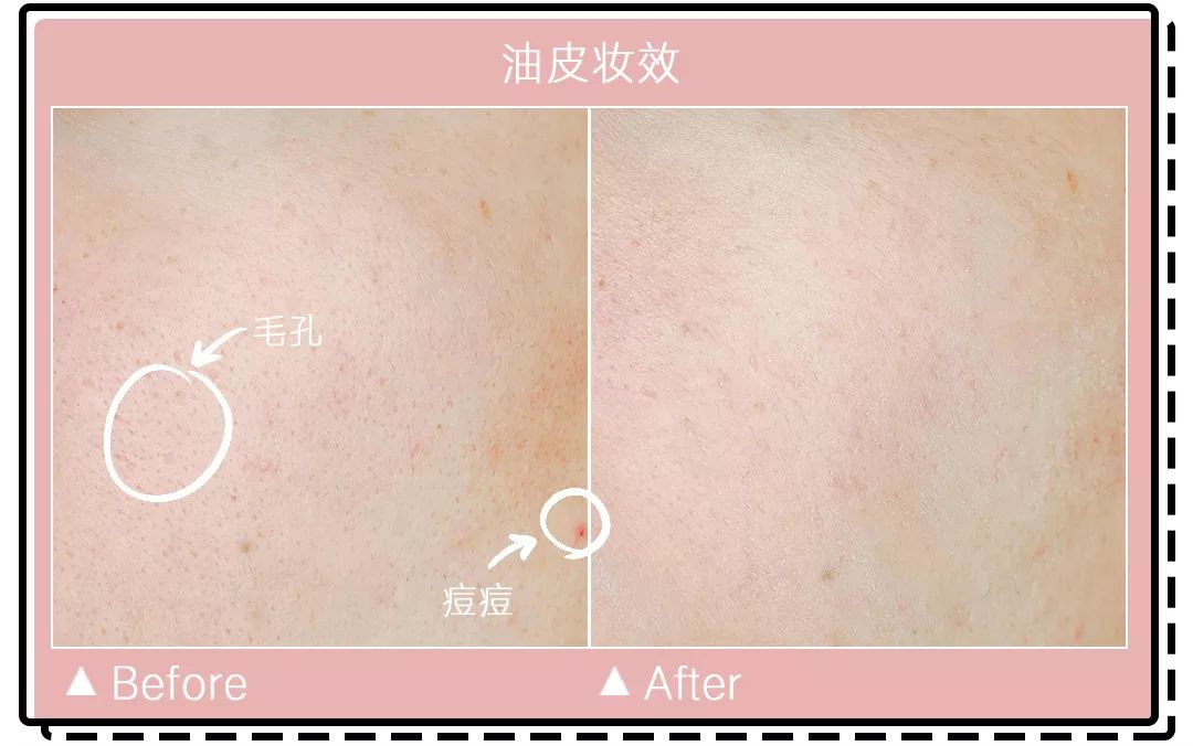 十大公认好用的混油皮粉底液排名,珀莱雅粉底液适合干皮还是油皮