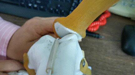 膝盖髌骨上下楼梯疼痛怎么办,髌骨外倾可以矫正过来吗