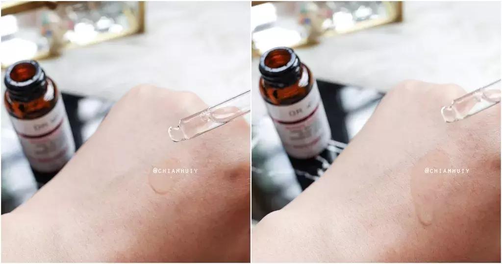 金银花对付痘痘,对付所有痘痘的药膏