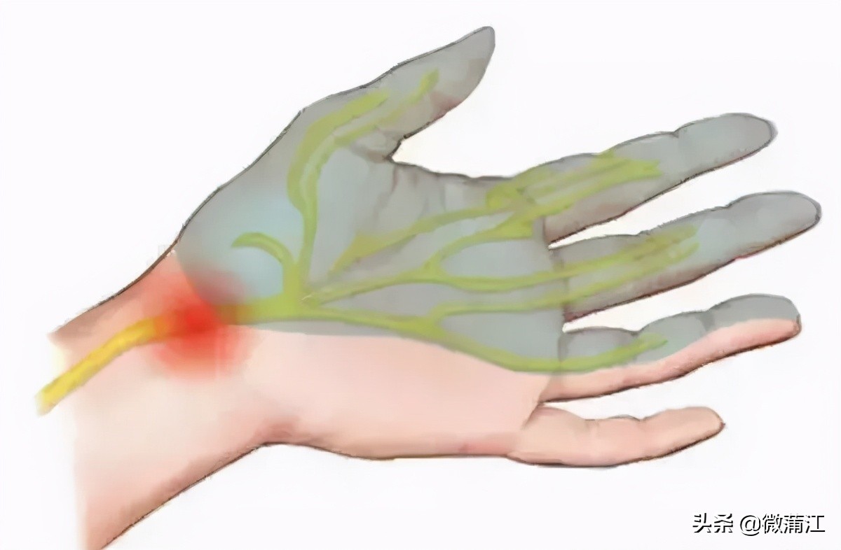 超声新技术医学影像,超声医学检查技术