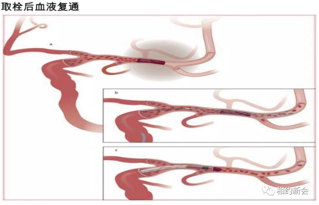 温县人民医院卒中中心,温县第二人民医院视频