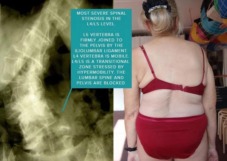 sps鍒涘浜虹悊鏌ュ痉,鐞嗘煡寰蜂翰鎺坰ps瀵煎笀