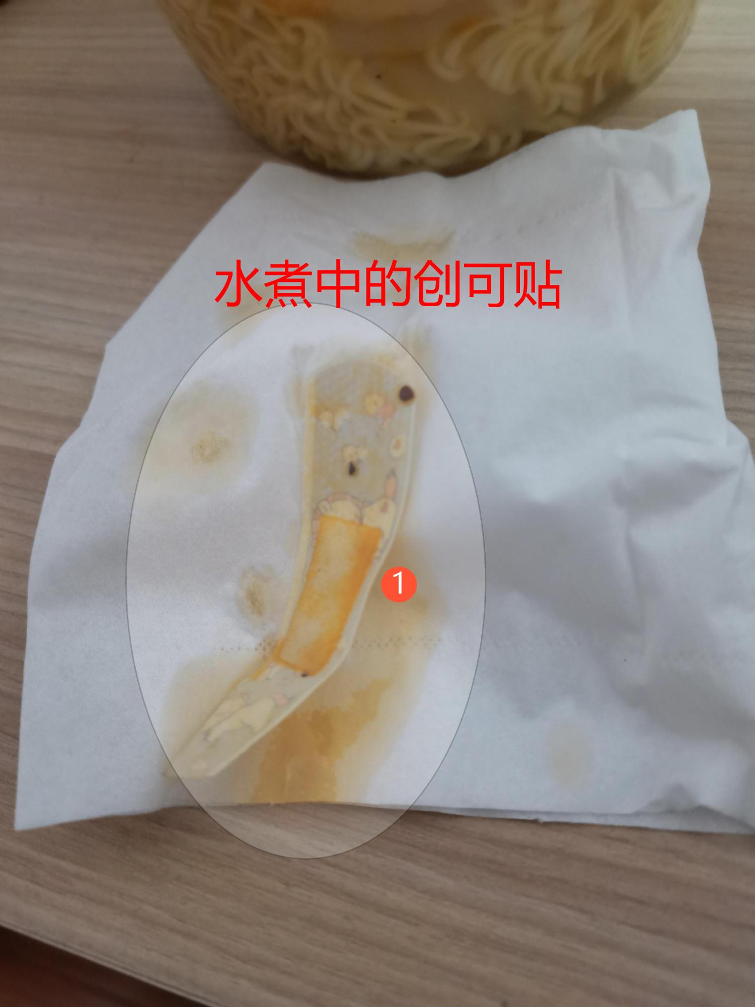 在饿了么点外卖吃出虫子,在饿了么平台点餐却不送货