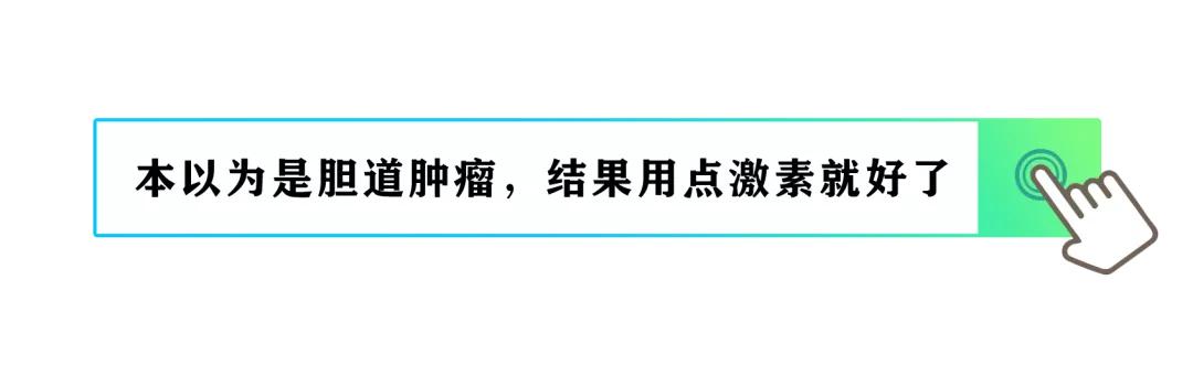 免疫球蛋白g4相关性胆管炎,以为是癌症