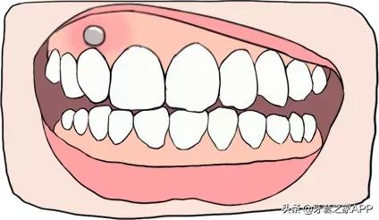 疫情复诊牙套能用吗现在,疫情期间牙齿出现问题怎么办