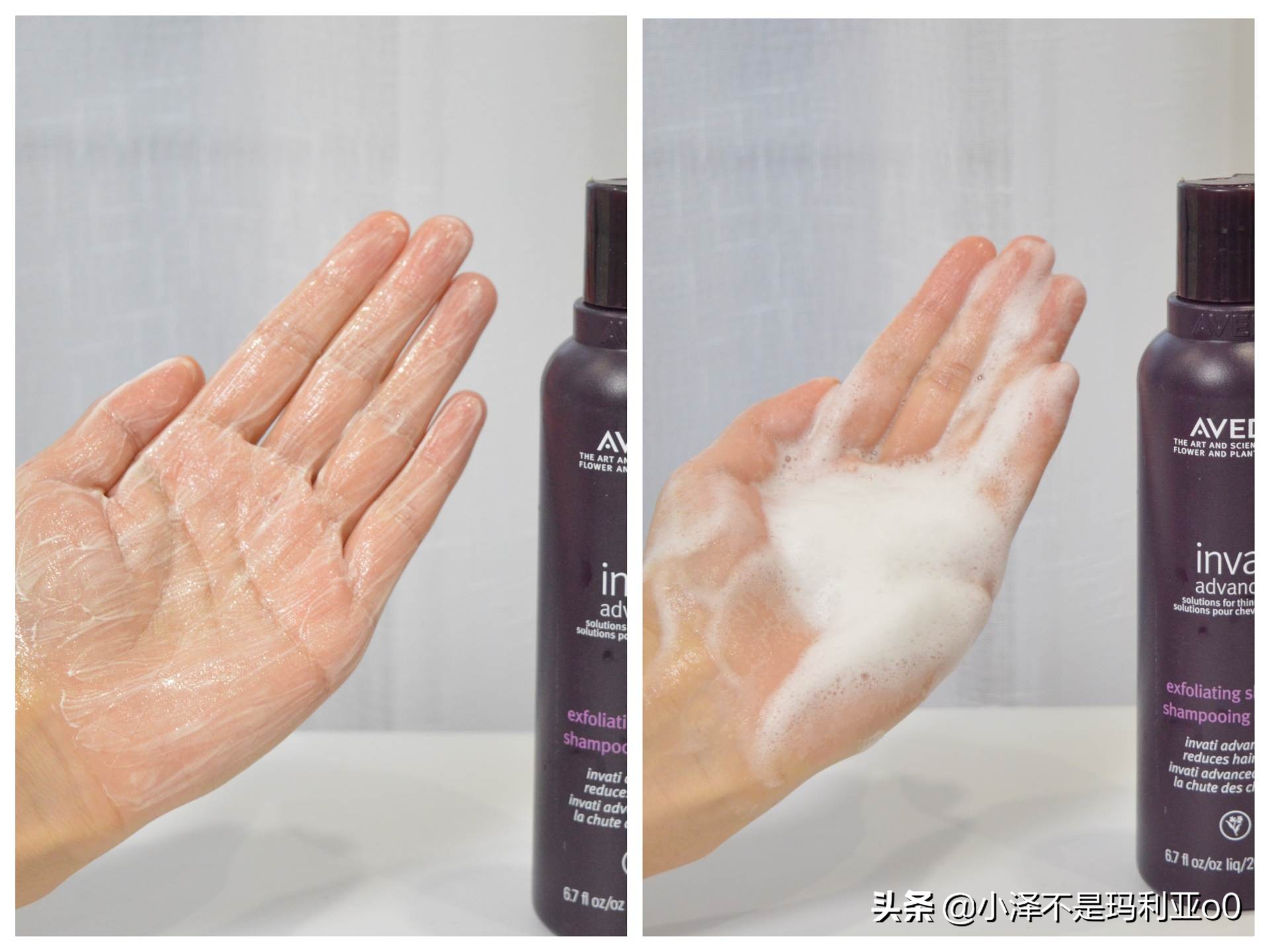 额头秃发际线后移适合什么洗发水,拯救发际线的洗发水