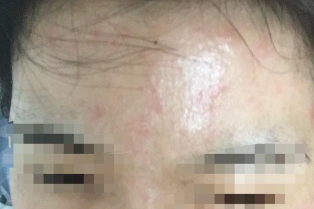 关于抗老成分视黄醇的使用误区,视黄醇跟a醇精华区别