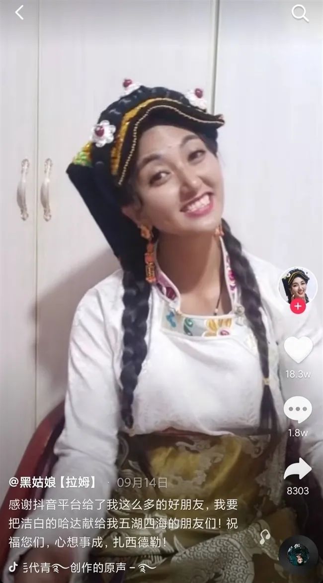 网红拉姆被害,网红拉姆被烧后最新消息