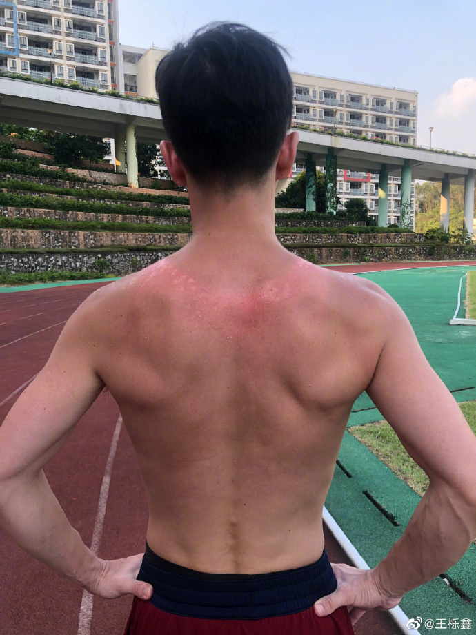 王栎鑫眼睛肿成悲伤蛙照片,王栎鑫晒照