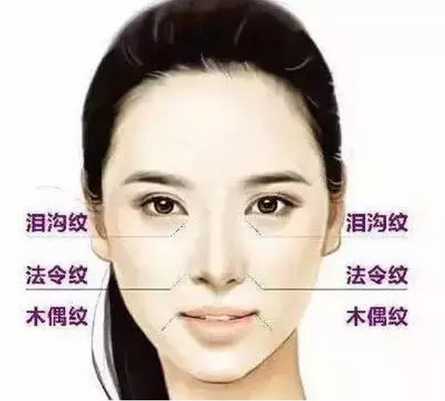 脸上的三八纹能改善吗,三八纹越来越明显了咋办