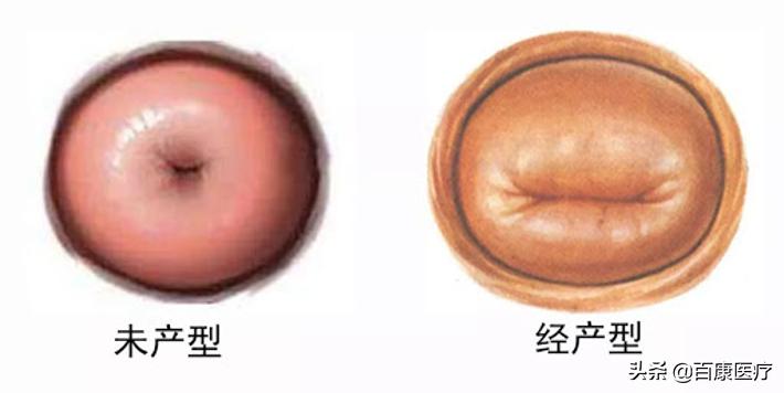 做过人流有案底婚检可以查出来吗,做过人流婚检医生会说吗