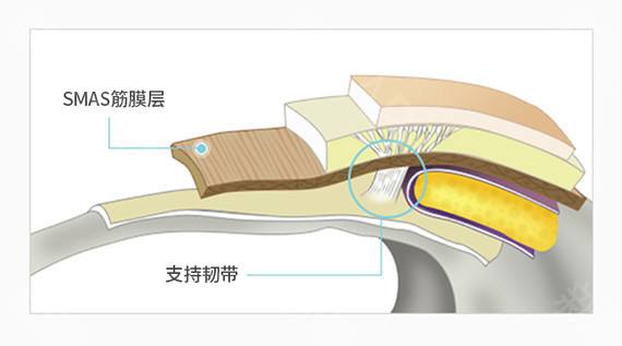 面部紧致提拉抗衰针,紧致抗衰面部训练