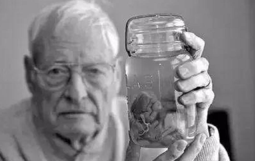 爱因斯坦死后的大脑被人偷走了吗,爱因斯坦死后大脑竟然被保留