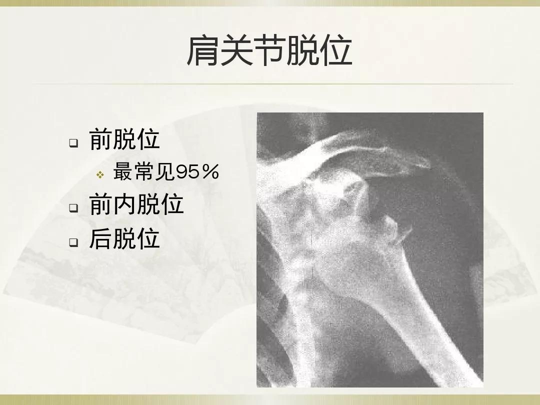 骨科x光片读片技巧,放射科骨科读片教程