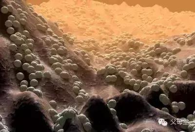 孩子上幼儿园后眼睛红肿长小疙瘩,孩子在幼儿园眼睛肿了