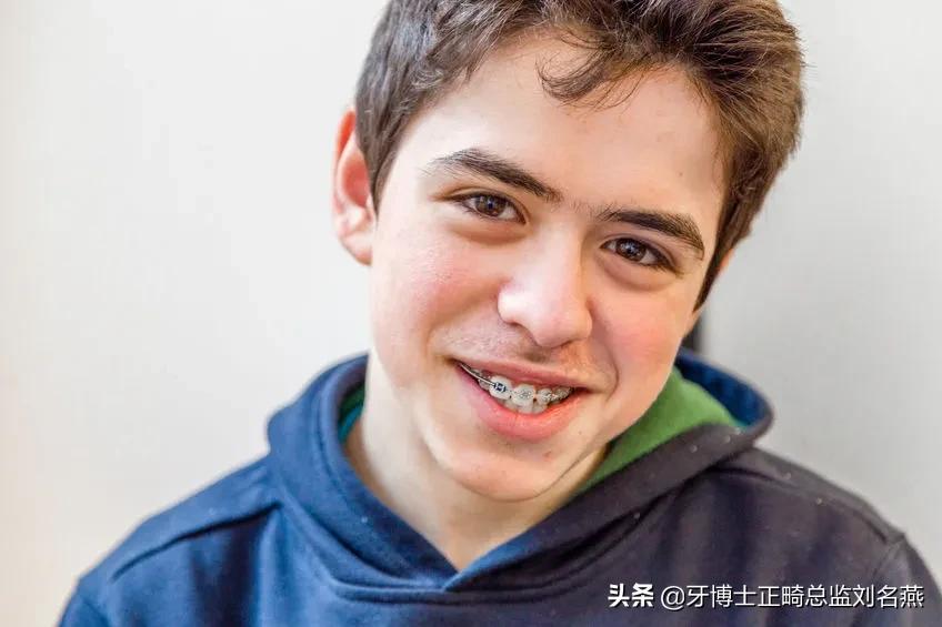 为什么托槽两小时就掉了,托槽为什么那么容易掉