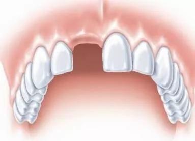 牙体牙髓科健康宣教图文,牙科医生的护牙知识科普