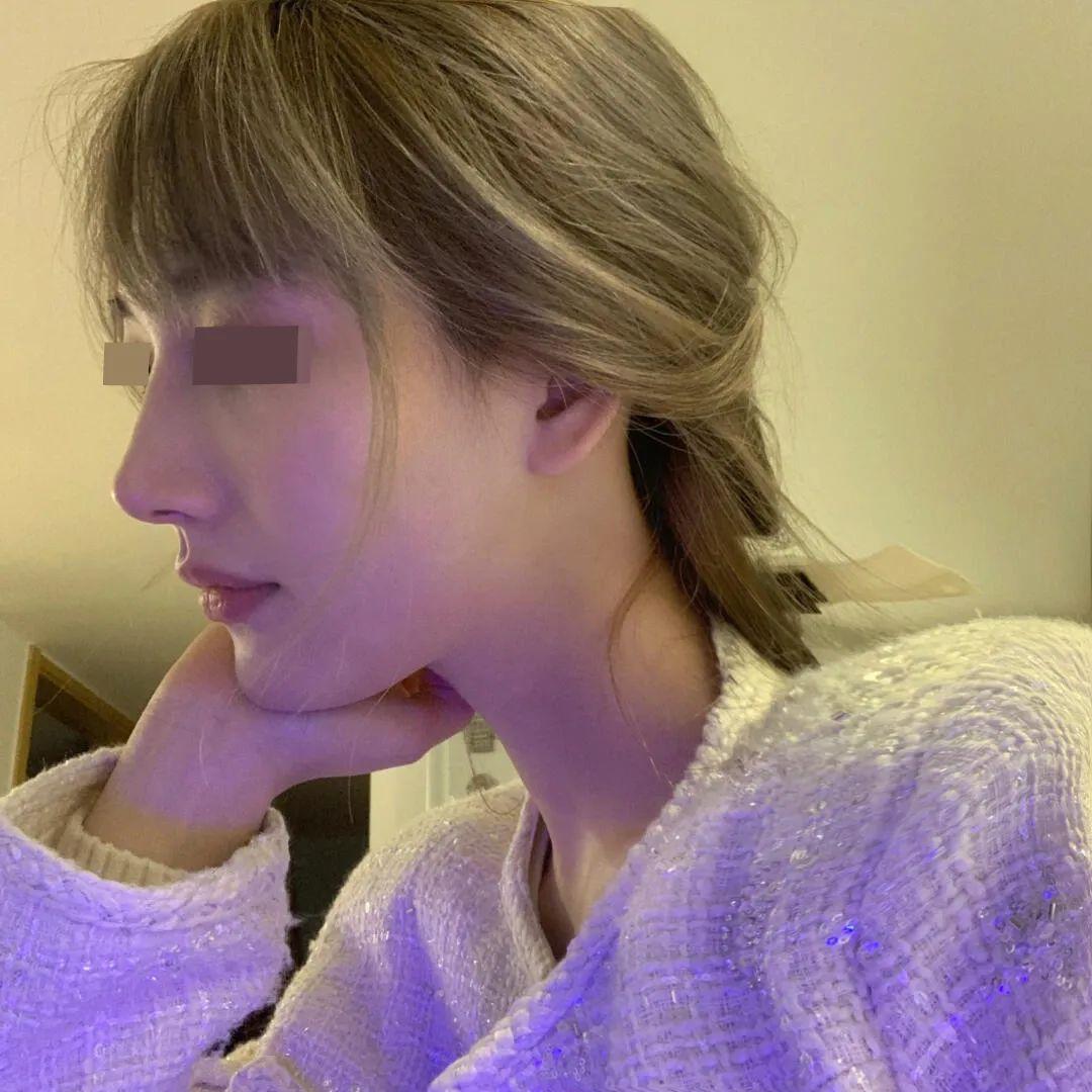 成年人如何自然美鼻,自然美鼻注意事项及禁忌