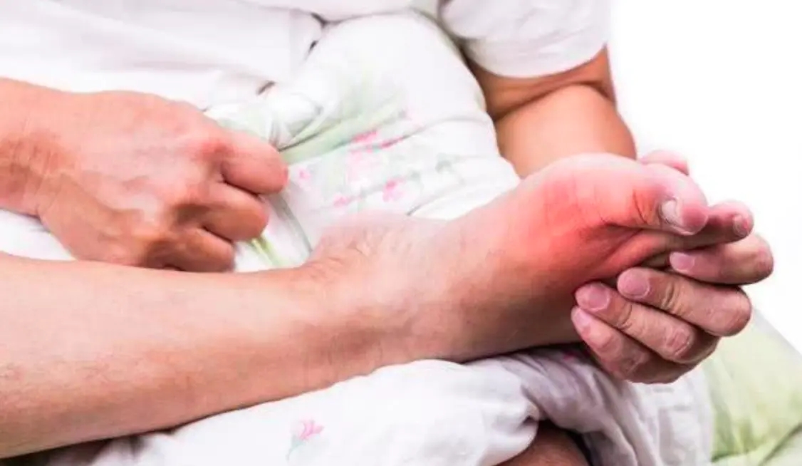 四种反常、五种方法霜清让痛风变得不再可怕