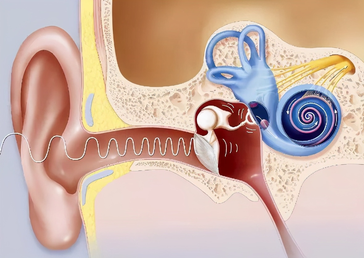 感觉神经性耳聋佩戴电子耳蜗,极重度双耳聋可以植入单侧耳蜗吗