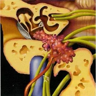 科普如何正确认识耳鸣,科普文的趣味性