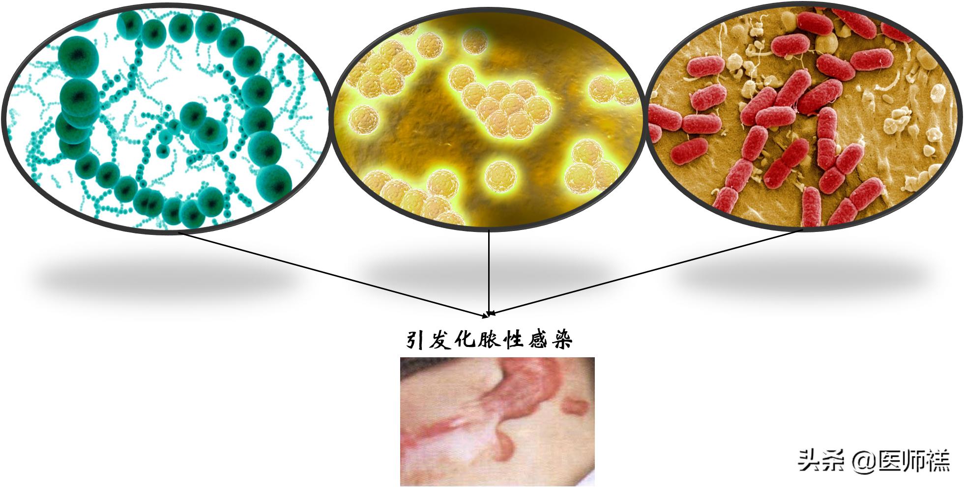 延时湿巾靠不靠谱，会带来哪些健康损害？医生提醒需要警惕这些