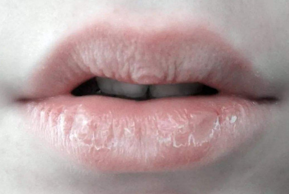 怎样涂口红好看又不掉色又不起皮,涂口红总是起皮怎么办