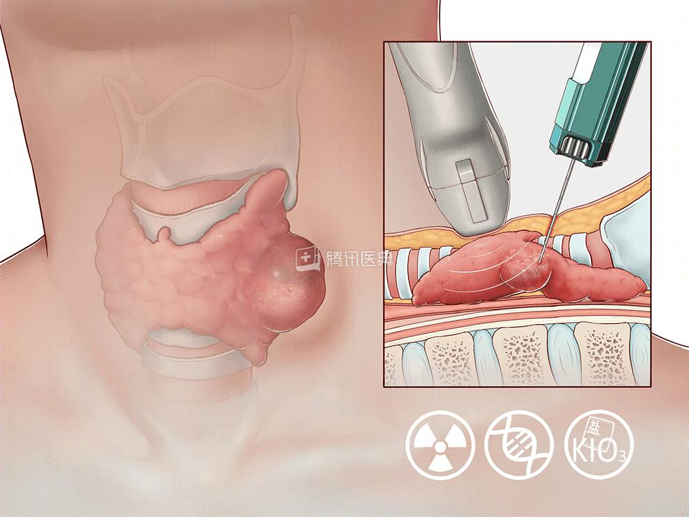 深圳癌症发病率最高的城市,深圳癌症多少例