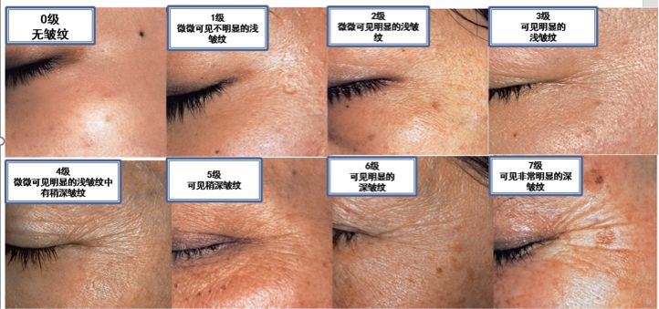 雅诗兰黛小棕瓶精华怎么购买划算,雅诗兰黛15元测评