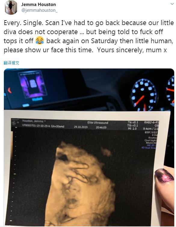 孕妈肚子里孩子反应很大搞笑视频,孕妈产检发现多了个宝宝