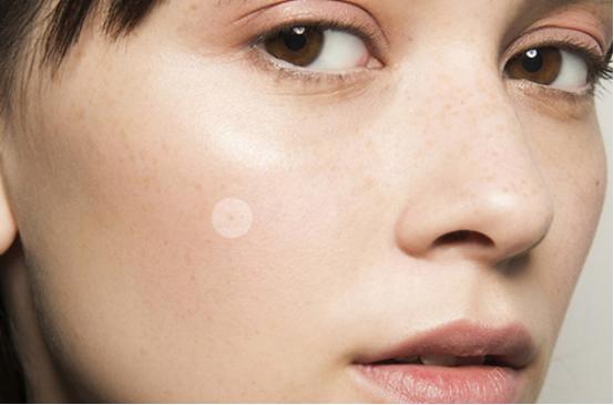 贴痘痘贴前要做好什么,痘痘贴怎么能贴牢