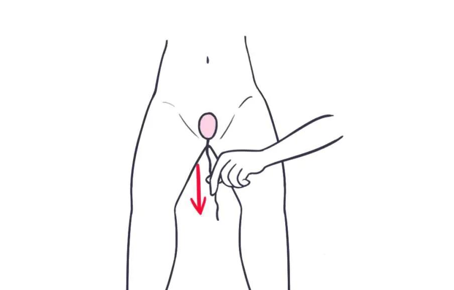 产后哑铃是治疗什么的,产后为什么哑铃总是掉出来