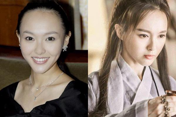 发际线高怎么办用什么药,发际线高怎么办改善