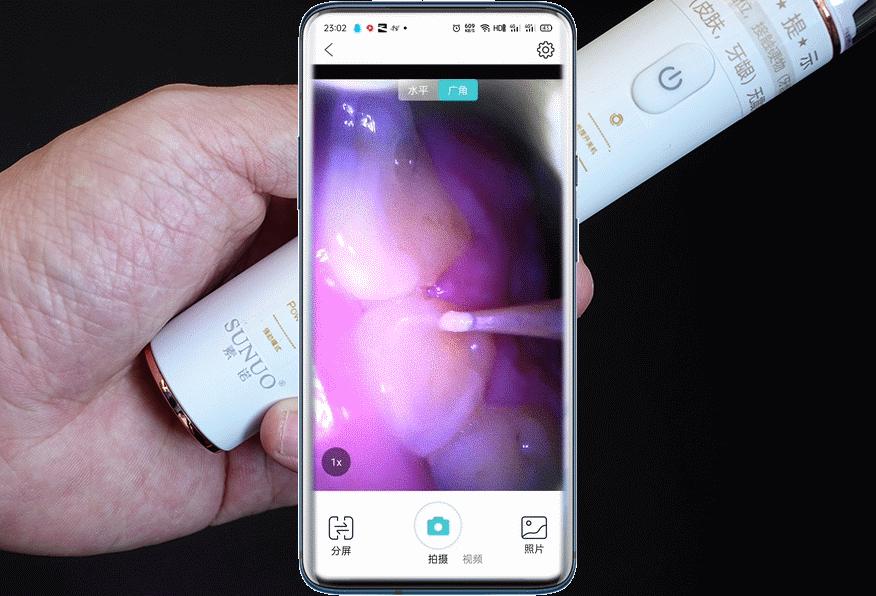 超声波可视牙齿清洁器,智能可视超声波洁牙仪洗牙步骤