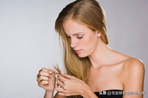 每天洗头头皮屑还是很多怎么解决,天天洗头却有很多头皮屑怎么解决