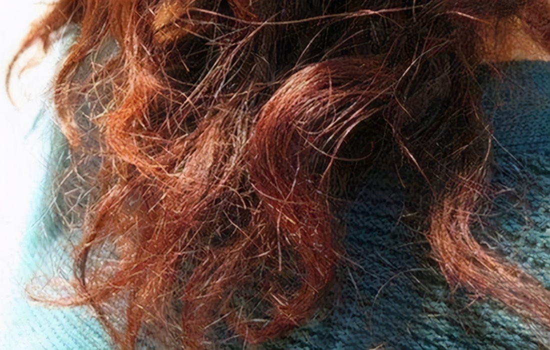 有什么办法让头发不毛躁,头发毛躁蓬松怎样才能变柔顺