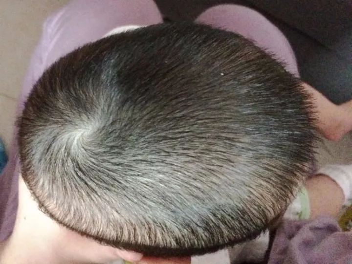 宝宝头睡偏了可以平睡纠正吗,头偏长的宝宝怎么睡头型